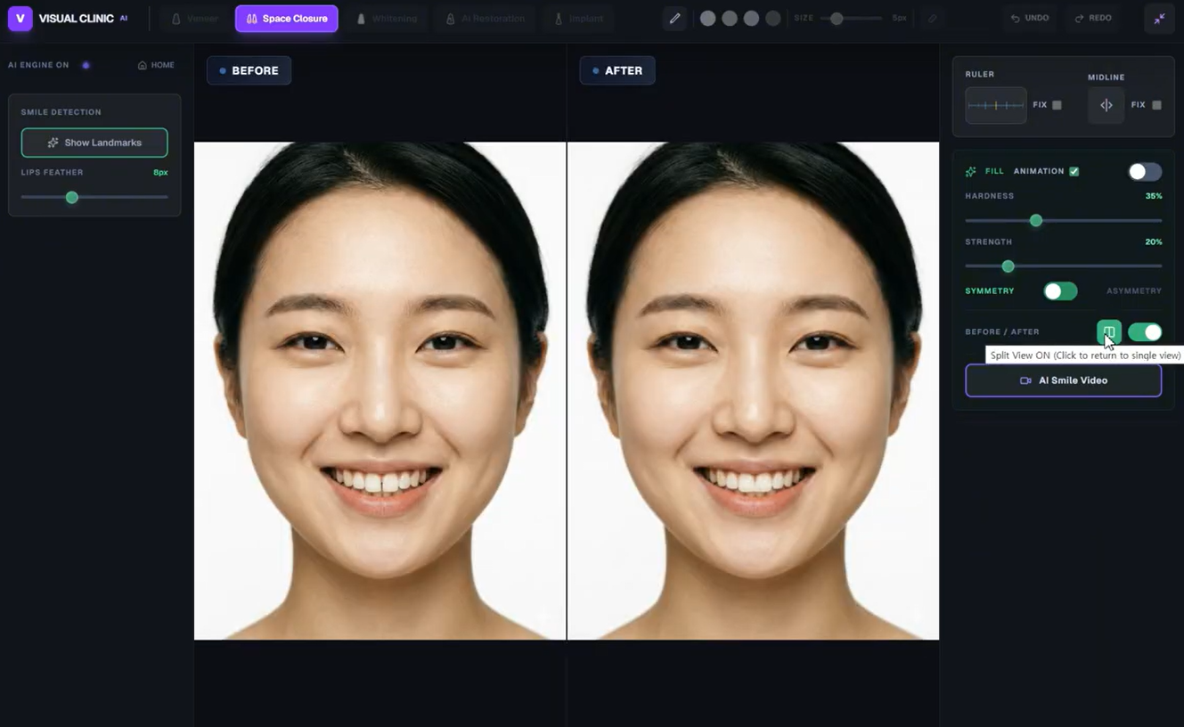 전치부 케이스